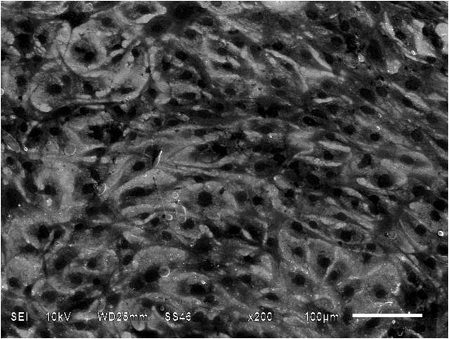 A kind of preparation method of multifunctional vascular stent