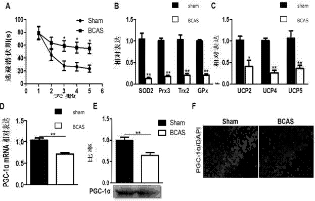 Application of PGC-1Alpha (peroxisome proliferator-activated receptor-gamma coactivator-1alpha) in preparation of medicines for treating vascular dementia