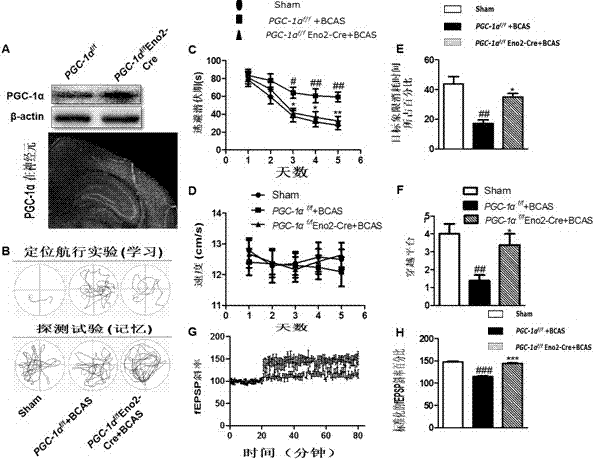 Application of PGC-1Alpha (peroxisome proliferator-activated receptor-gamma coactivator-1alpha) in preparation of medicines for treating vascular dementia