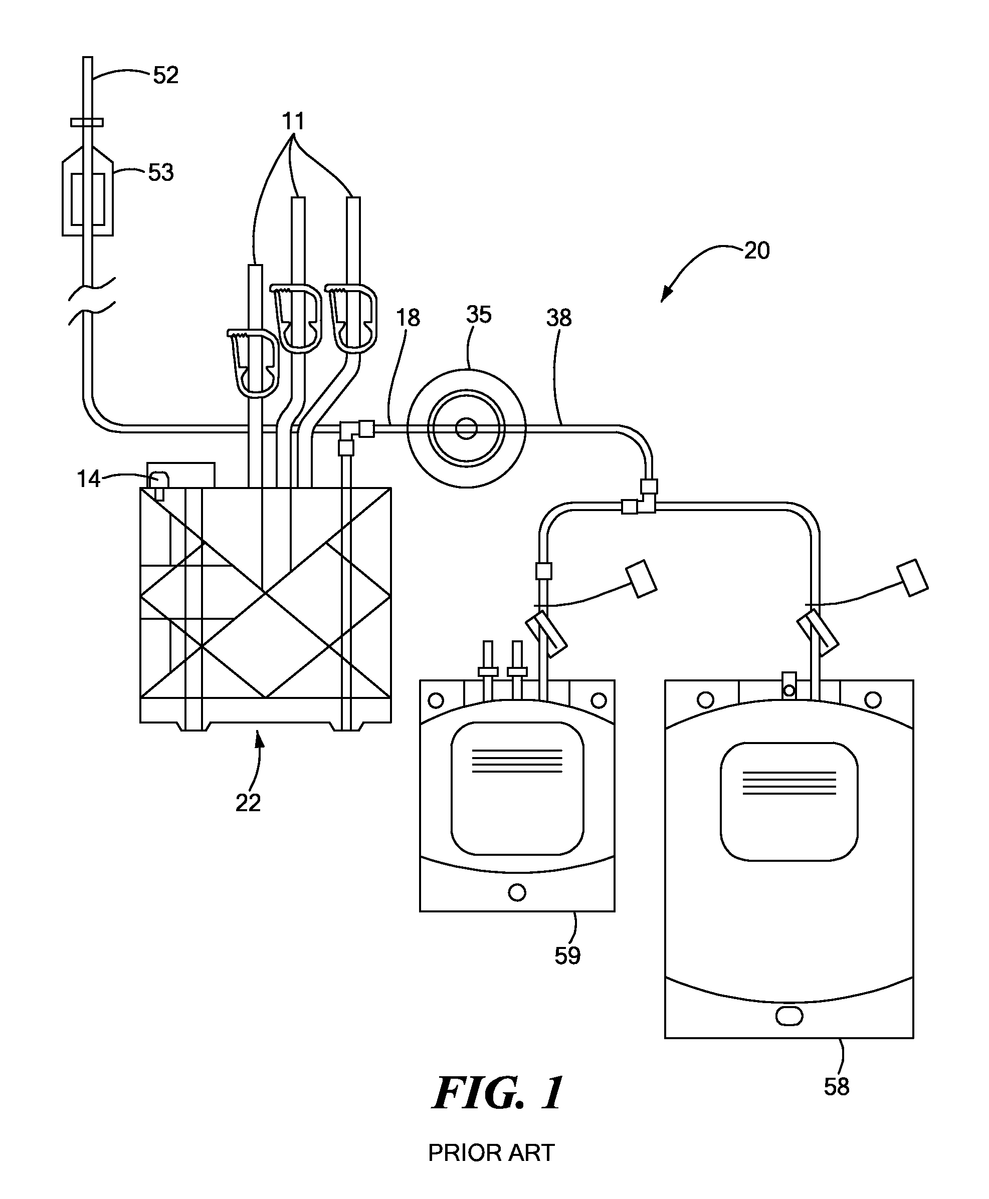 Adaptable Perioperative Cell-Salvage System and Methods and Disposable Units for Same