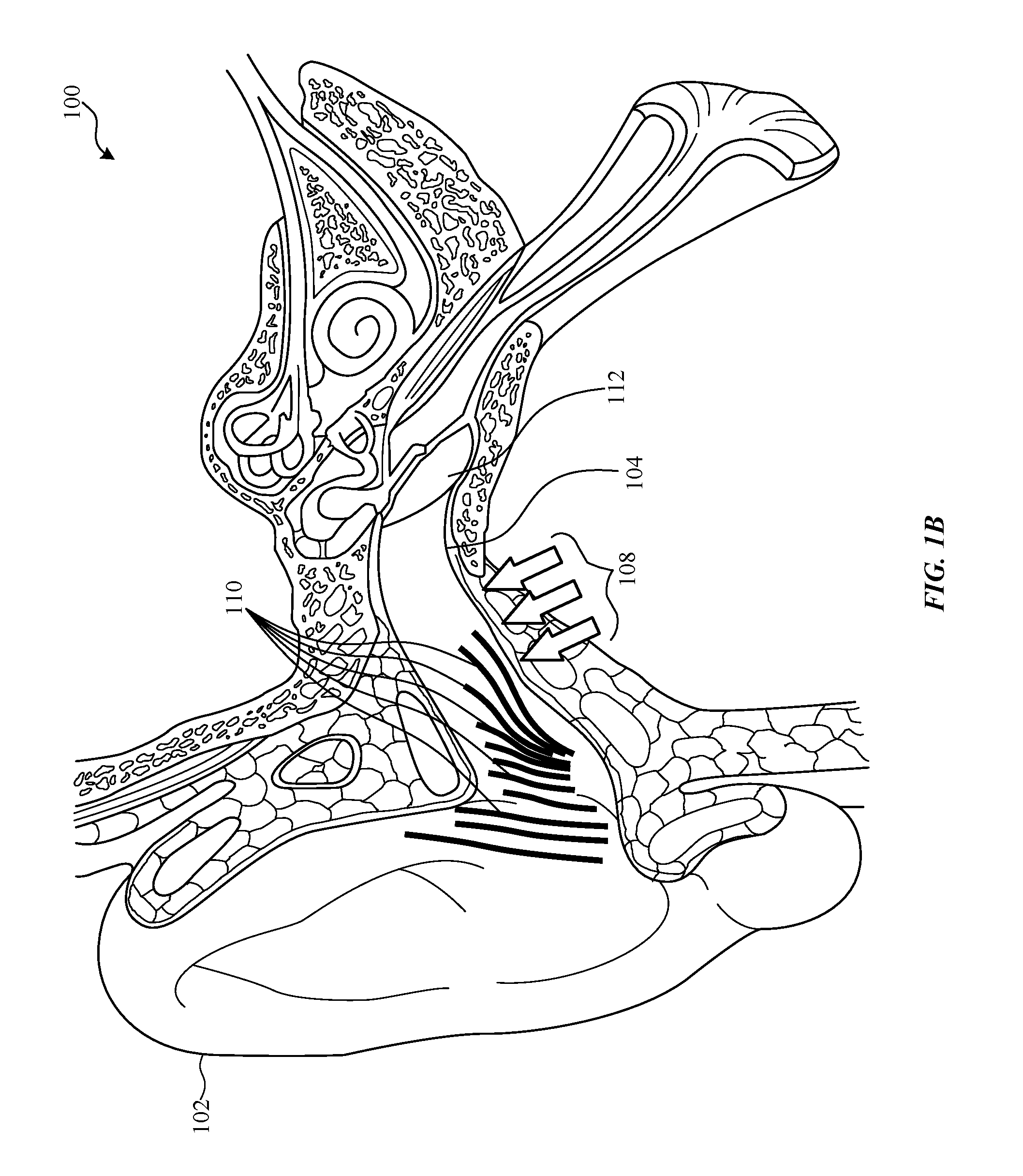 Balanced armature based valve