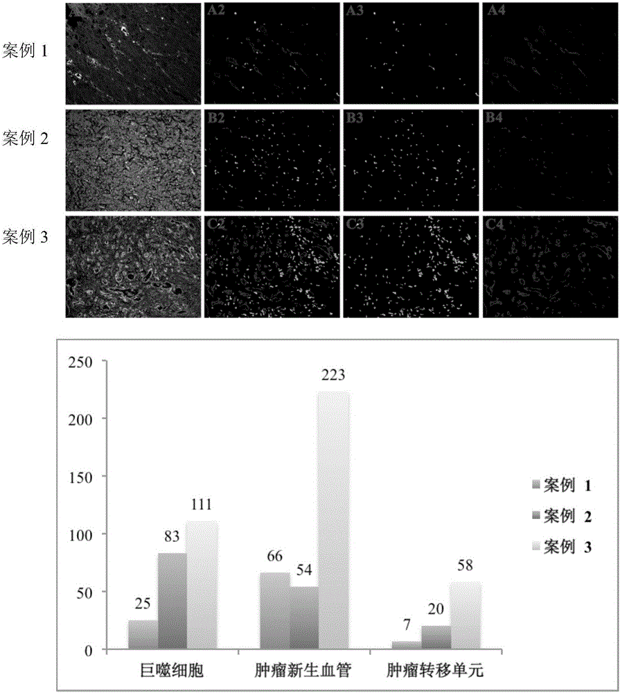 A method for counting tumor metastasis units based on quantum dot spectral analysis and image analysis