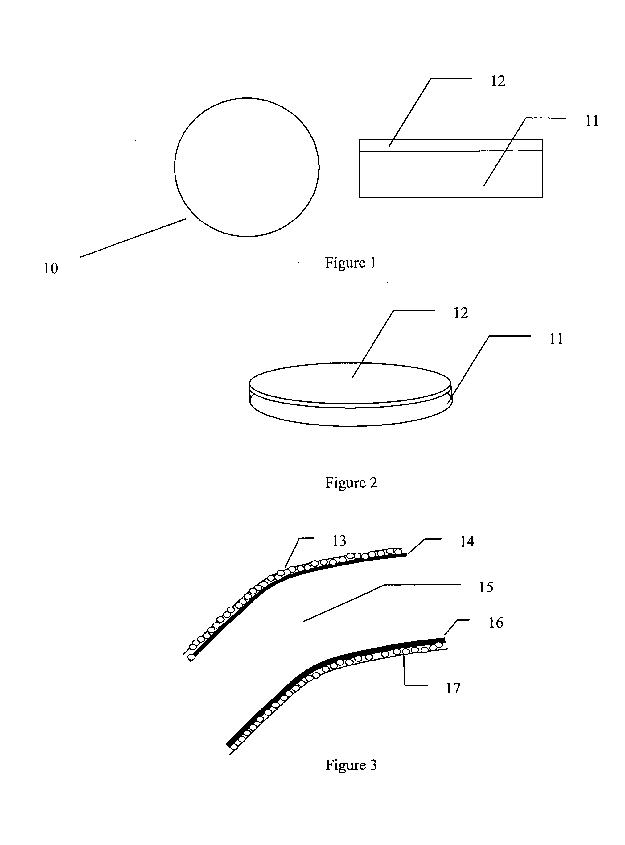 Resorbable Cornea Button