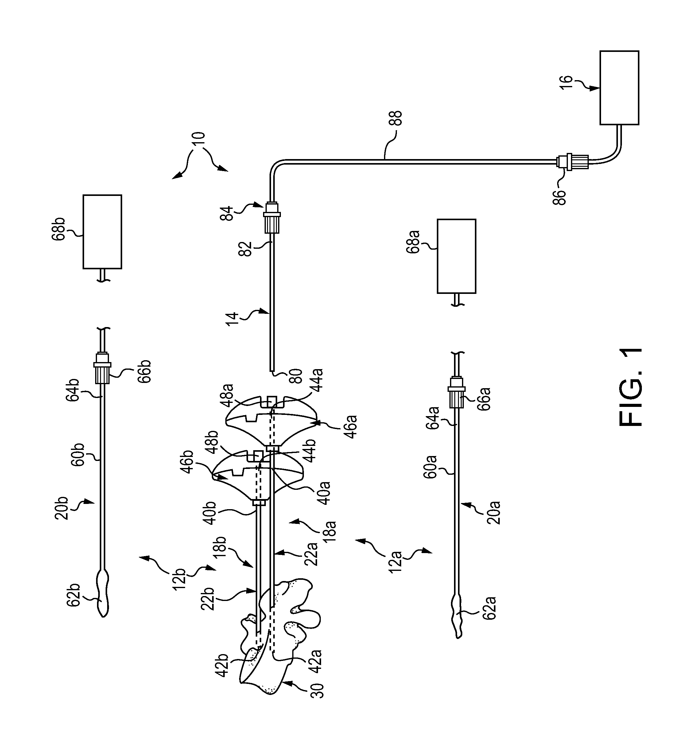 Method for balloon-aided vertebral augmentation