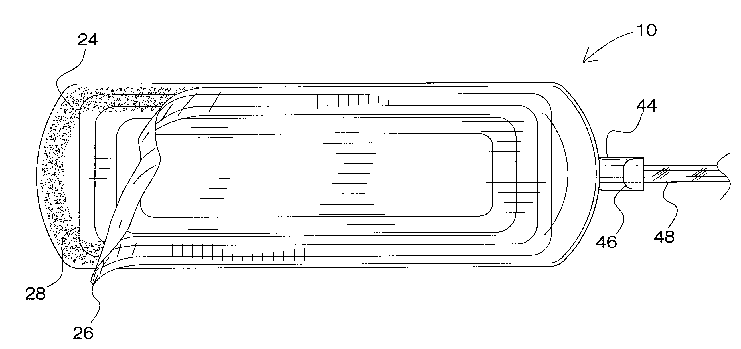 System and Method for Draining Bodily Fluids from a Treatment Site