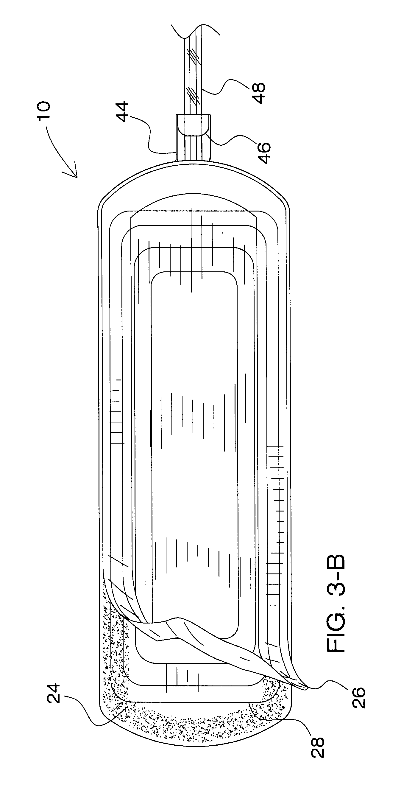 System and Method for Draining Bodily Fluids from a Treatment Site