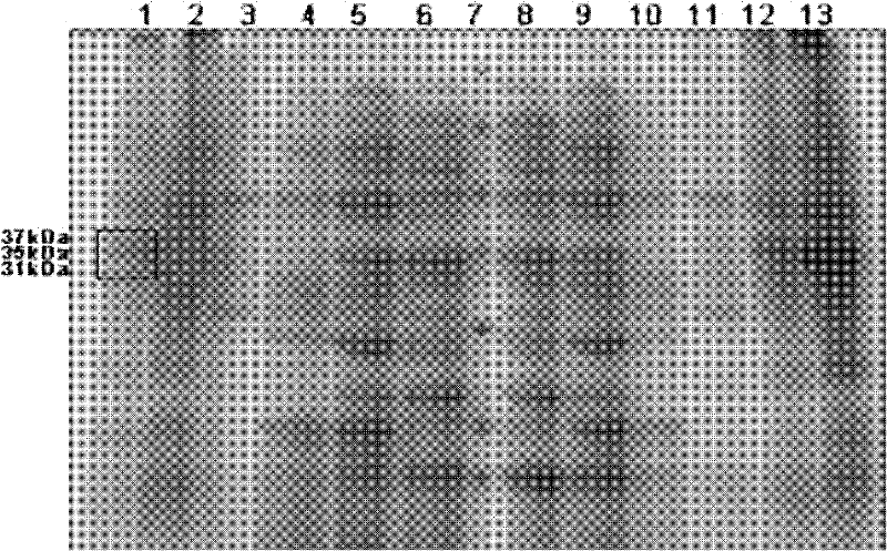 Extraction and purification method of plasminogen activator pla of Yersinia pestis