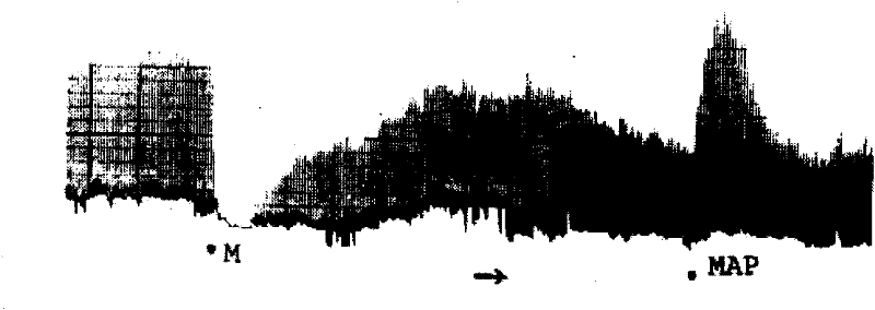 Active fragment of anti-opioid peptide