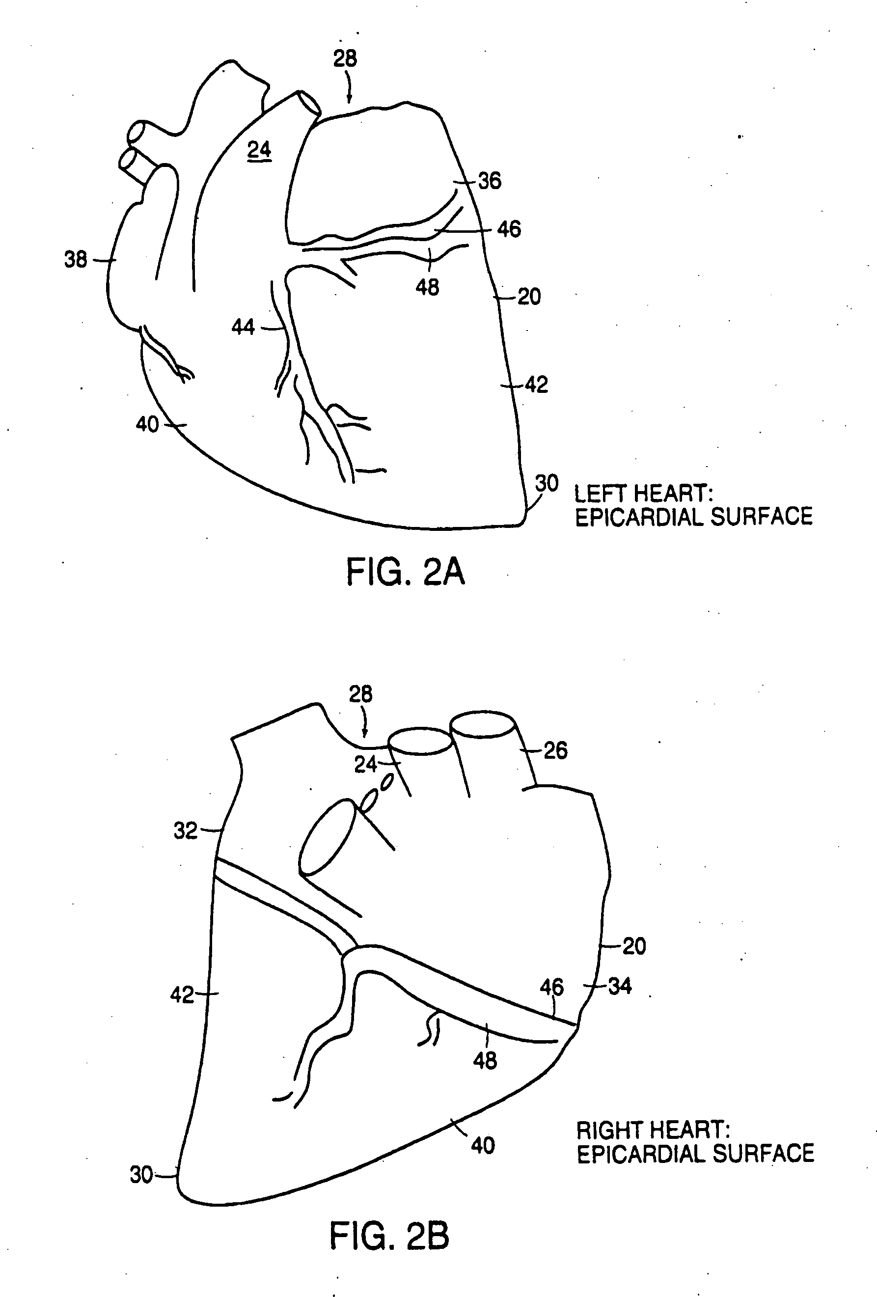 Cardiac ablation system and method for treatment of cardiac arrhthmias and transmyocardial revascularization