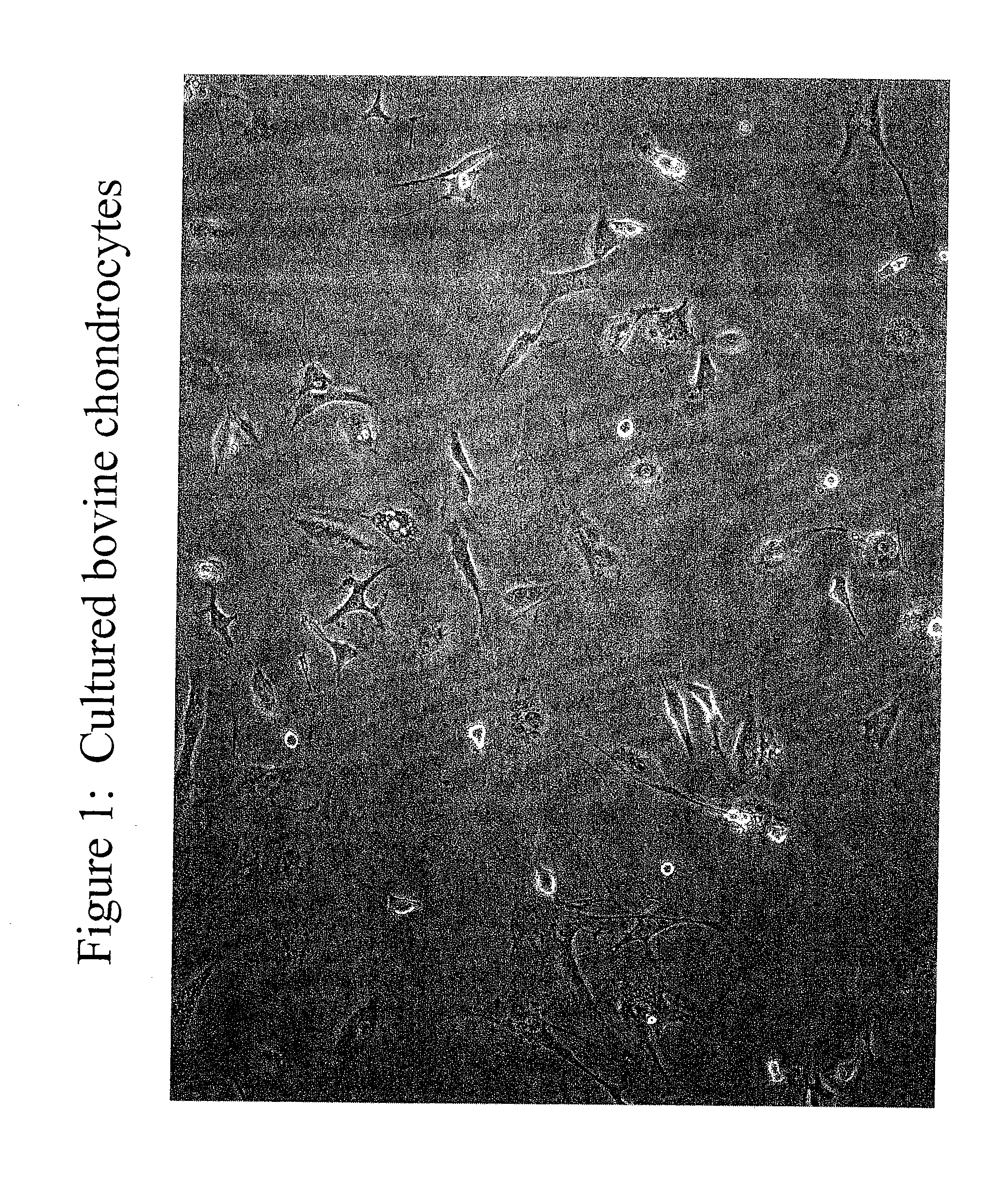 Chondrocyte Therapeutic Delivery System