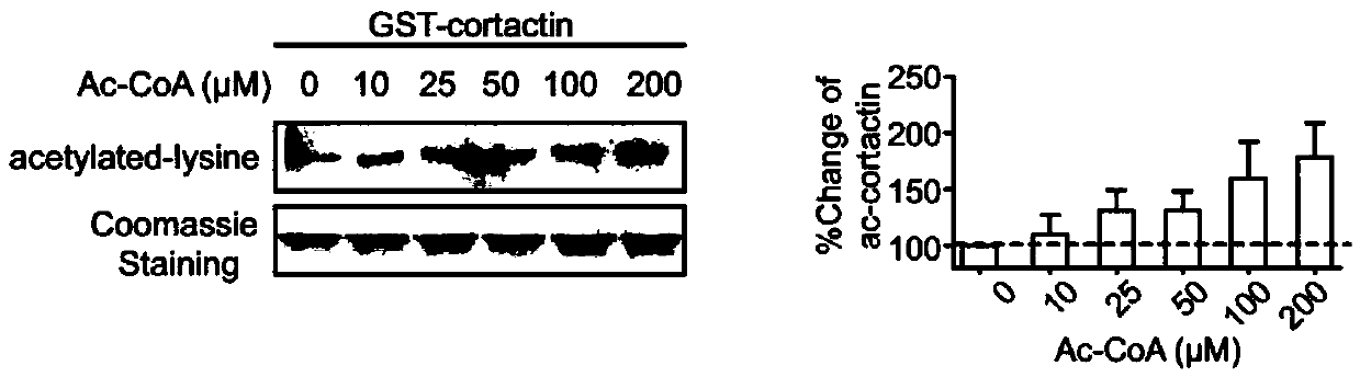 Cortex actin mutant 8KQ and application