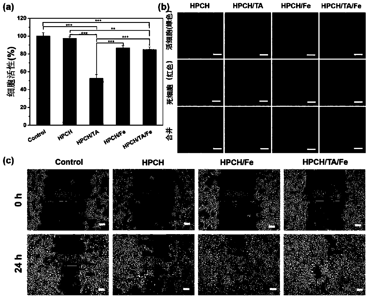 Injectable temperature-sensitive compound antibacterial hydrogel material containing tannin and preparing method and application of compound antibacterial hydrogel material