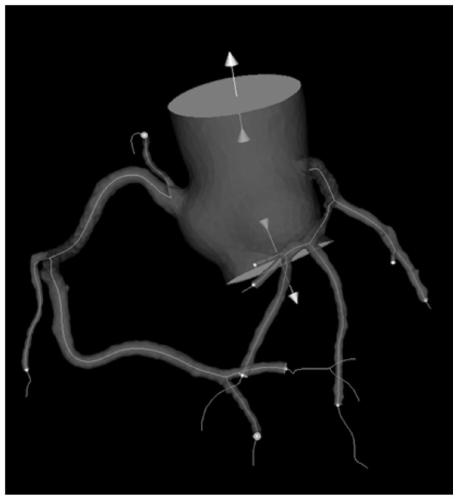 Virtual coronary artery operation bypass analysis method and system, medium and equipment