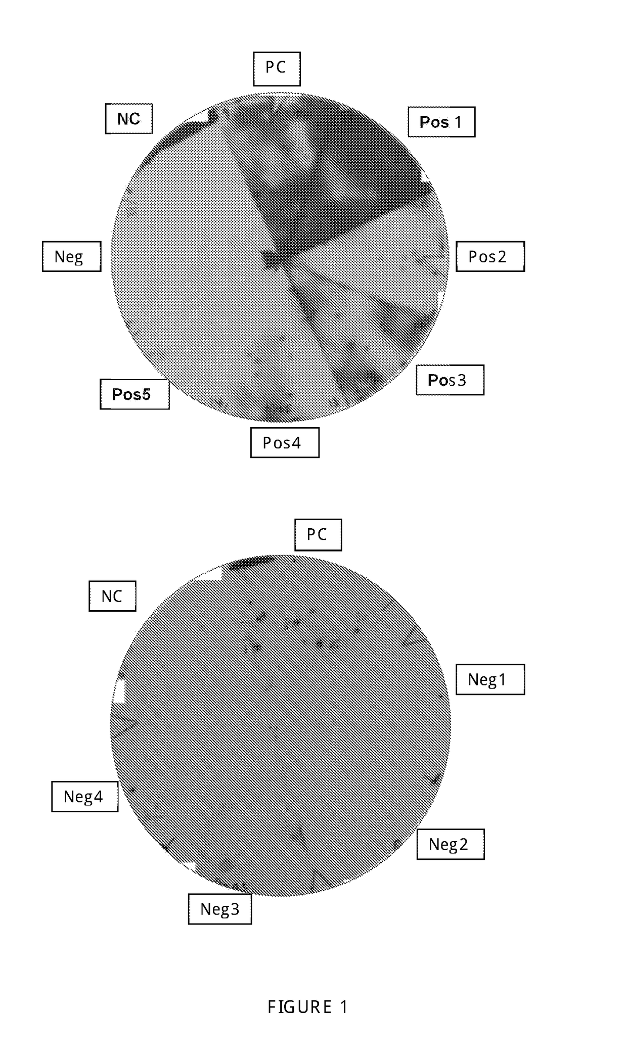 Strongyloides stercoralis protein and/or corresponding DNA and RNA sequences for application in diagnosis