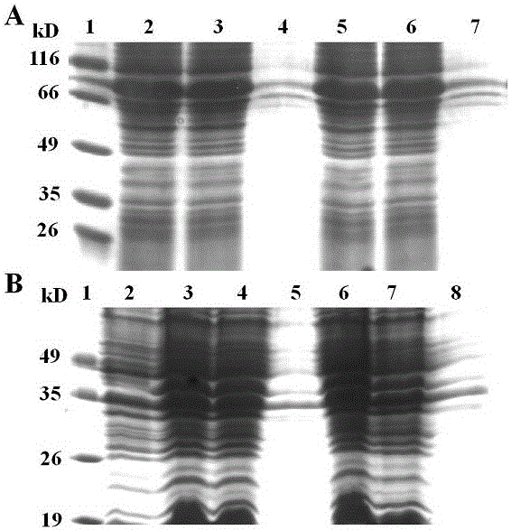 Recombinant human fibroblast growth factor 21 fusion protein and application thereof in preparation of medicine for treating metabolic diseases