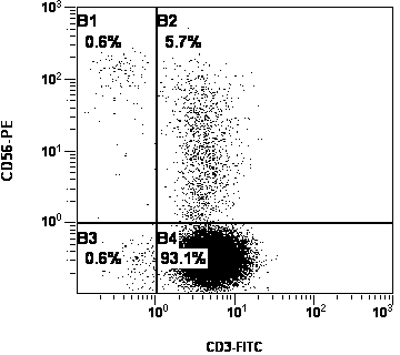 Culture method of autologous peripheral blood lymphocyte DC-CIK (Dendritic Cell- Cytokine-induced Killer)