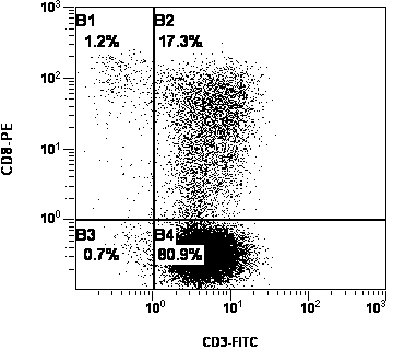 Culture method of autologous peripheral blood lymphocyte DC-CIK (Dendritic Cell- Cytokine-induced Killer)