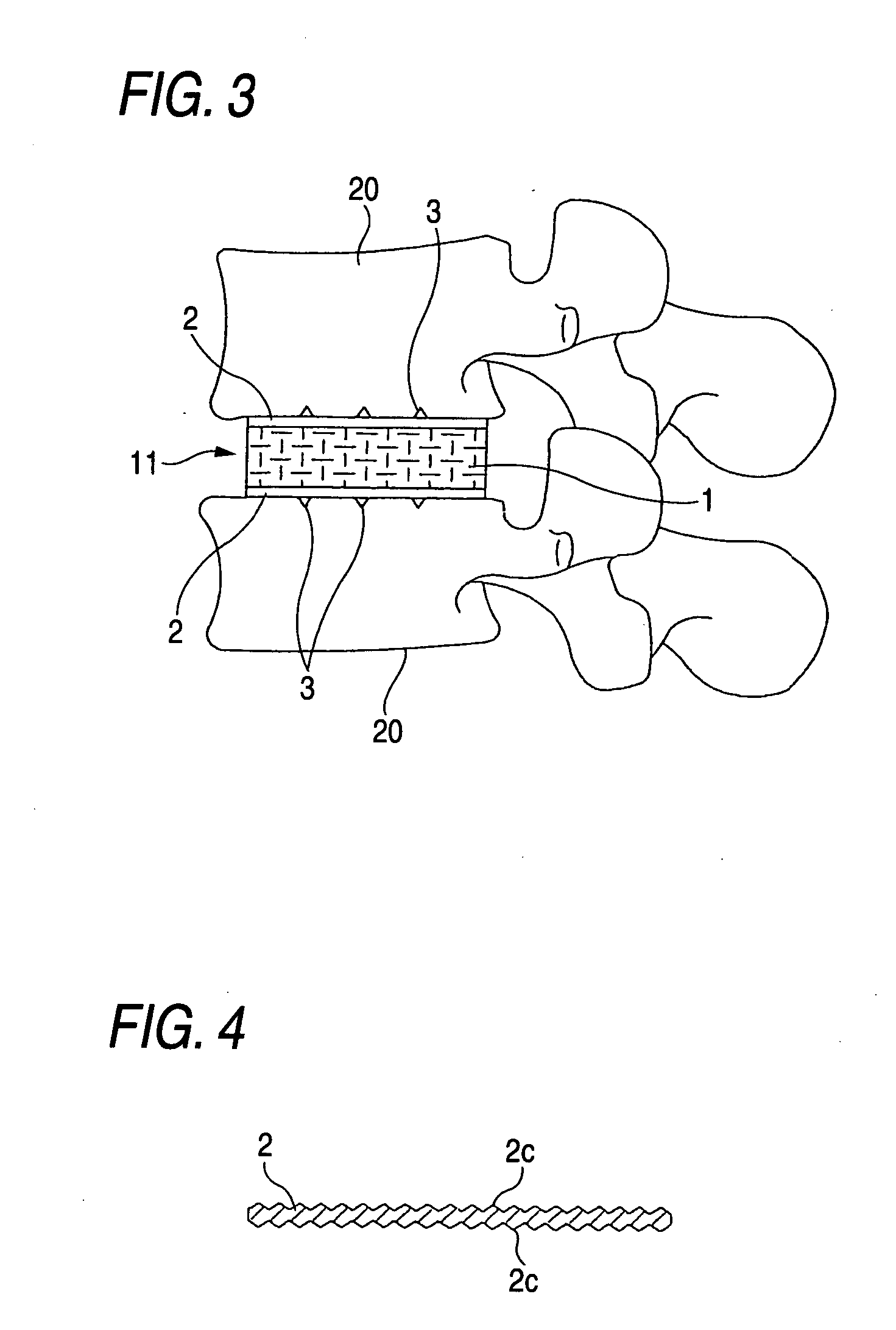 Biomaterial for artificial cartilage