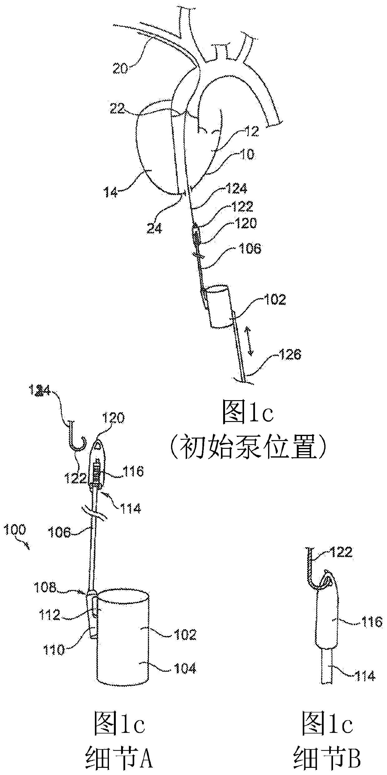 Aortic pump devices