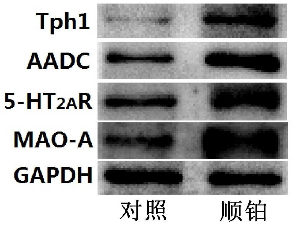 Application of a compound pharmaceutical composition in preparation of medicine for treating acute kidney injury