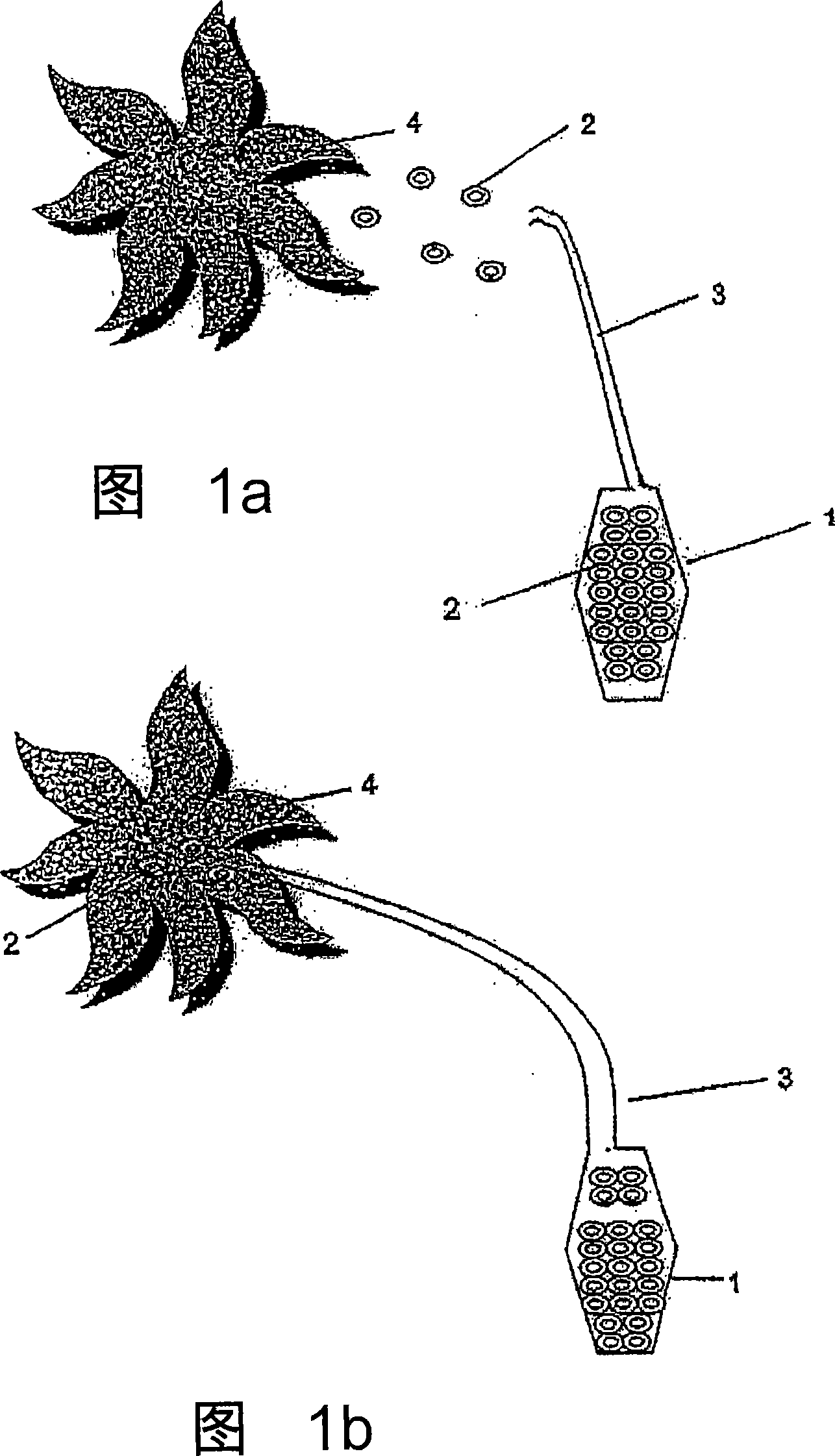 Controlled and directed local delivery of anti-inflammatory compositions