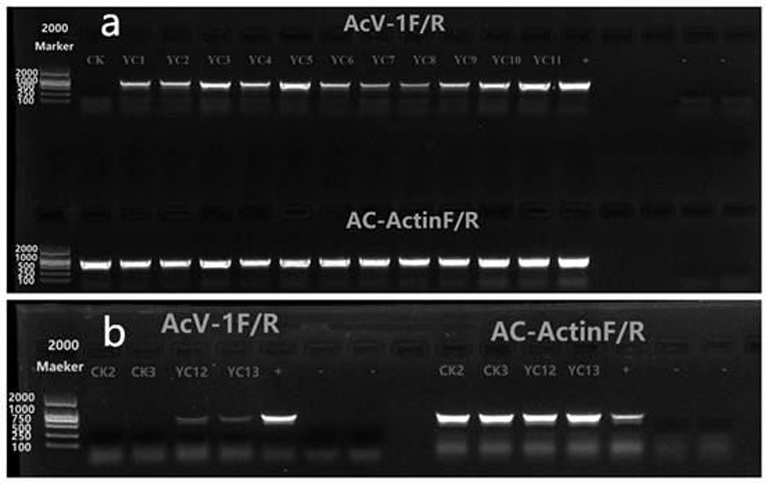 Arma chinensis virus specific CP detection primer and PCR detection method