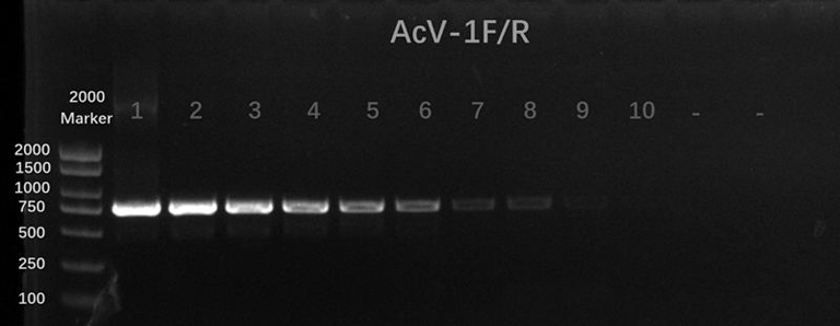 Arma chinensis virus specific CP detection primer and PCR detection method