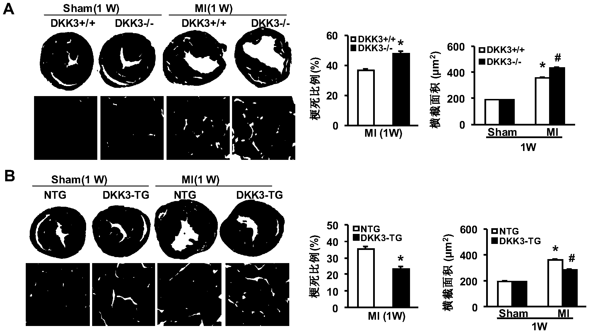 Function and application of Dickkopf-3 (DKK3) gene in coronary atherosclerotic heart disease