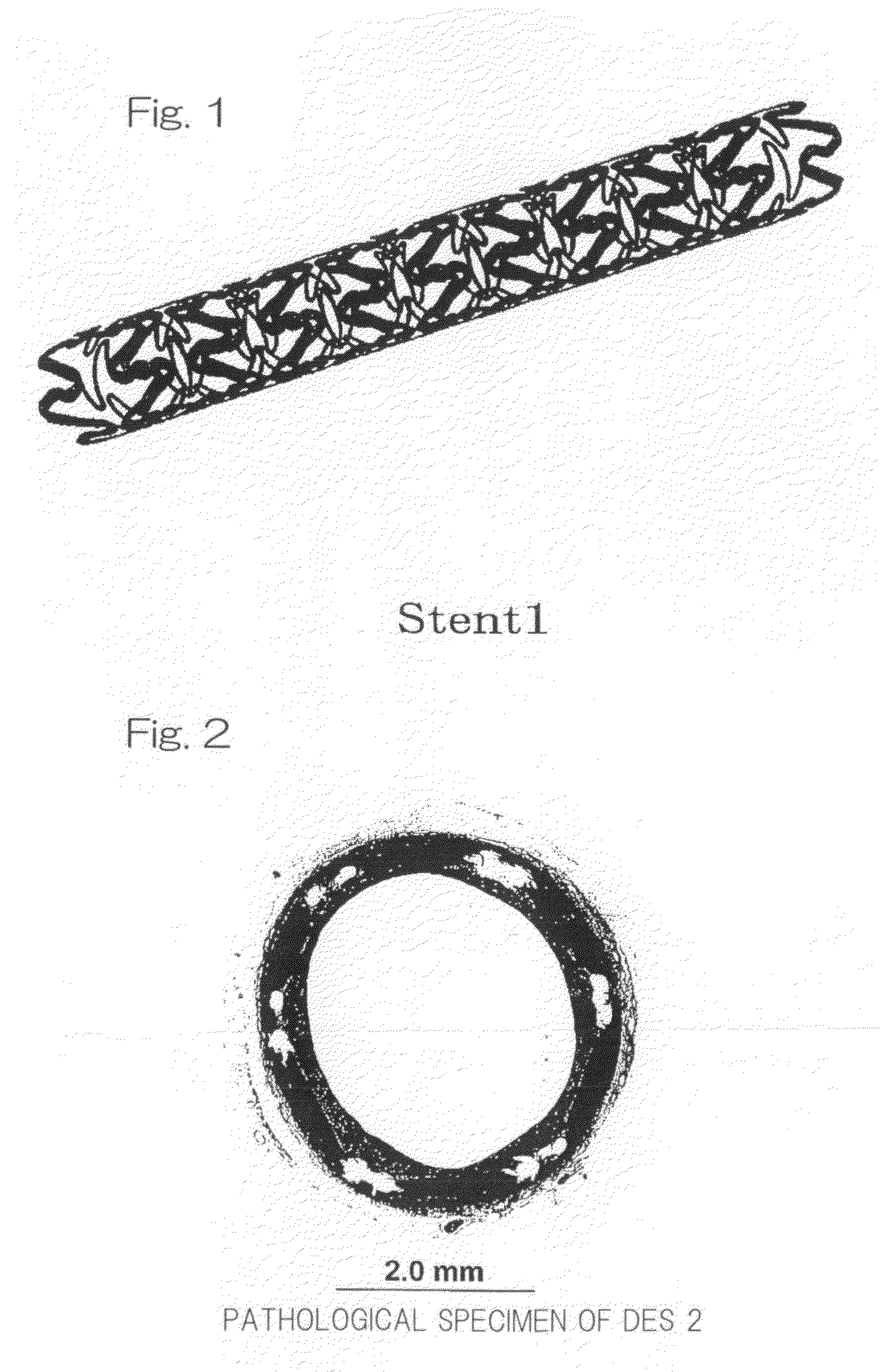 Drug-eluting stent