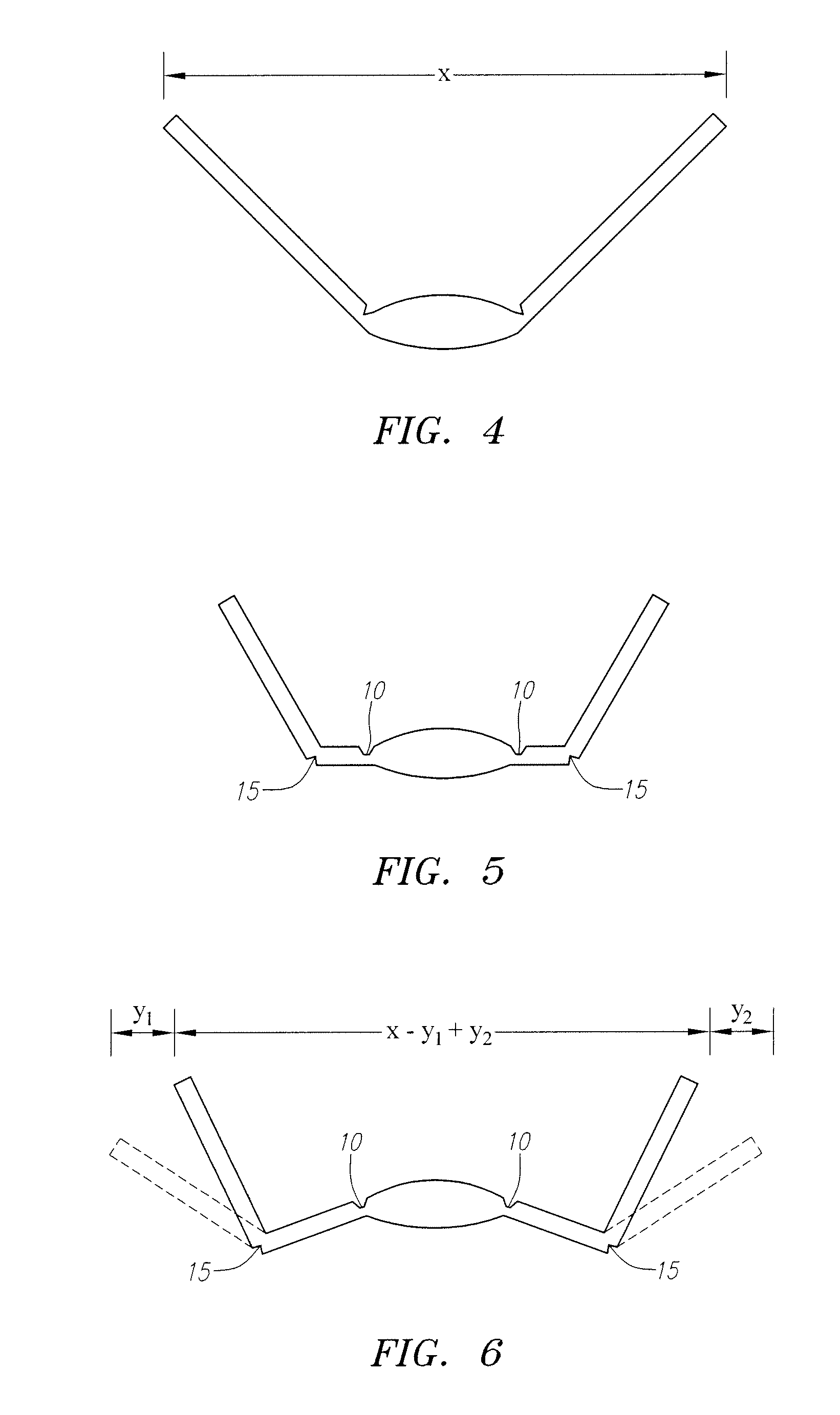 "w" accommodating intraocular lens with elastic hinges