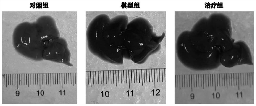 Application of MMI-0100 oligopeptide compound in preparation of medicine for treating cholestatic liver diseases