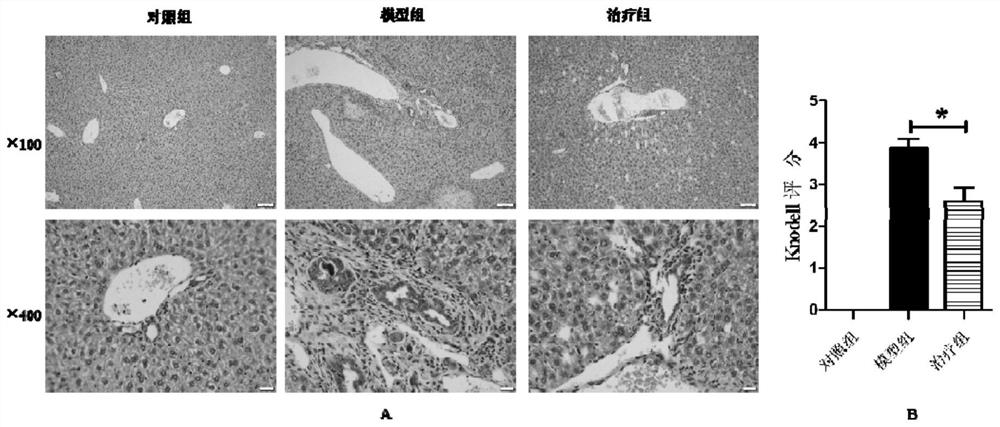 Application of MMI-0100 oligopeptide compound in preparation of medicine for treating cholestatic liver diseases