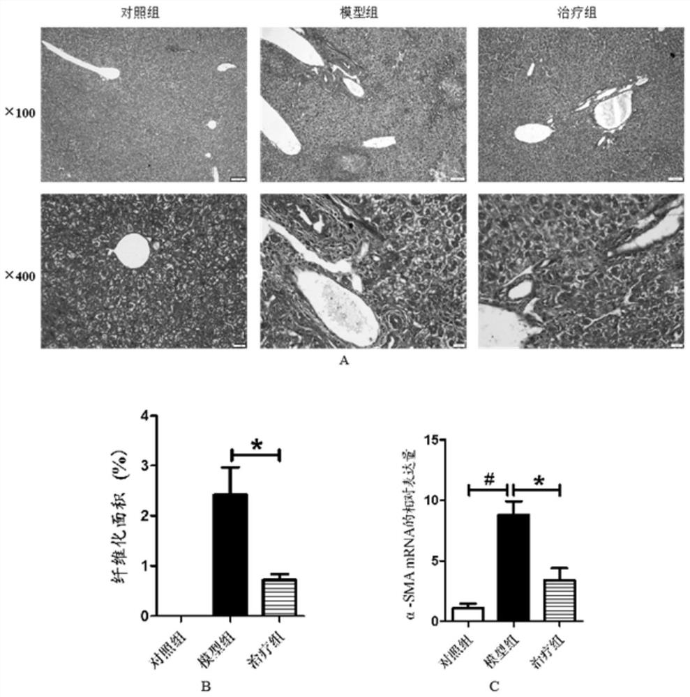 Application of MMI-0100 oligopeptide compound in preparation of medicine for treating cholestatic liver diseases