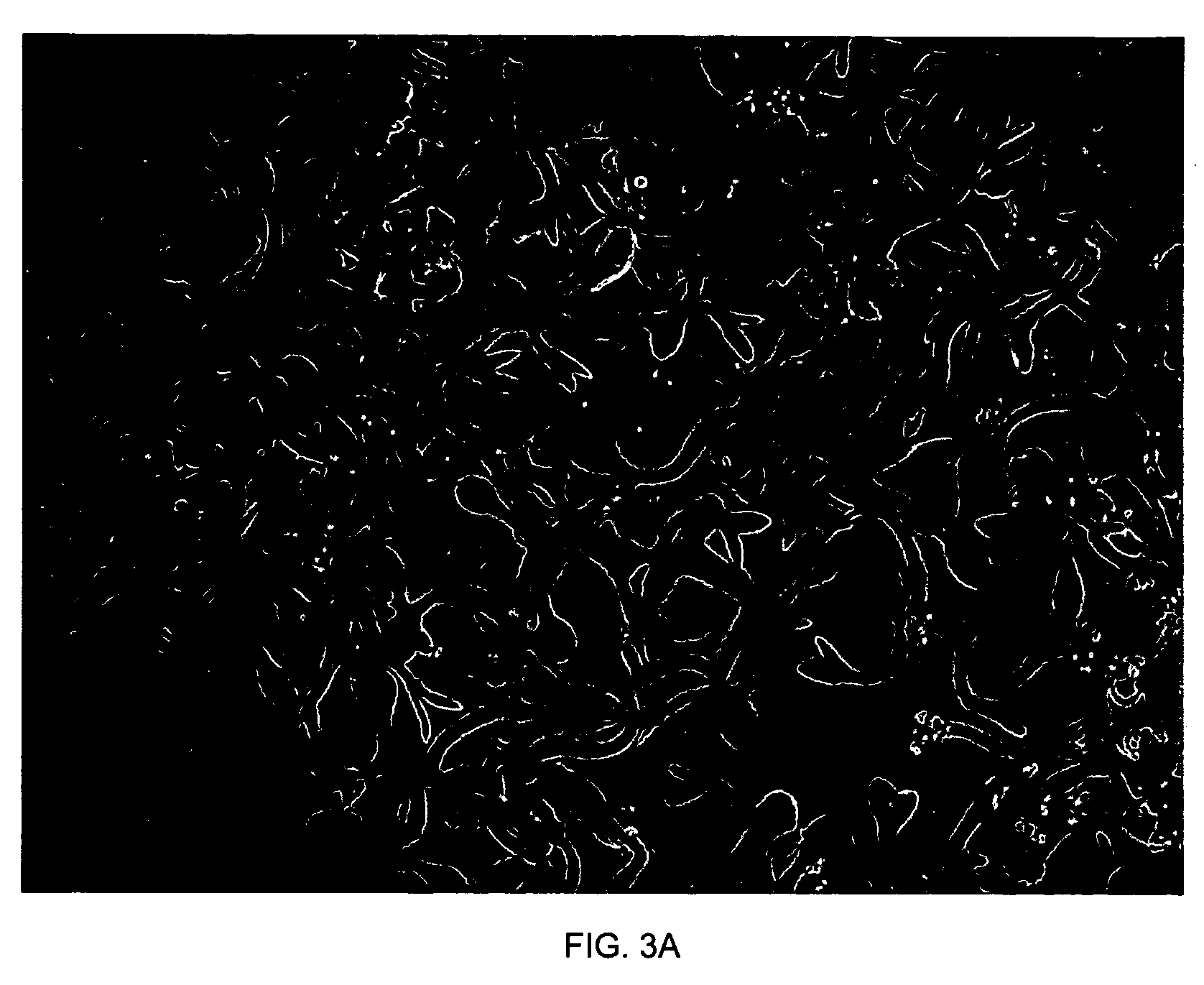 Bacteriophage for lysis of Methylobacterium and compositions and uses thereof