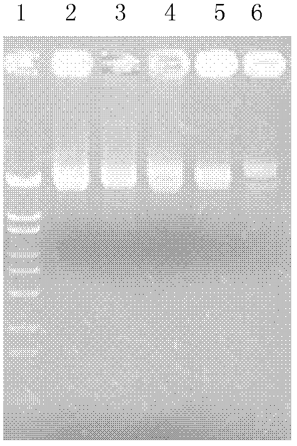 Tetrahymena expression vector of chitinases and its application in expressing chitinases