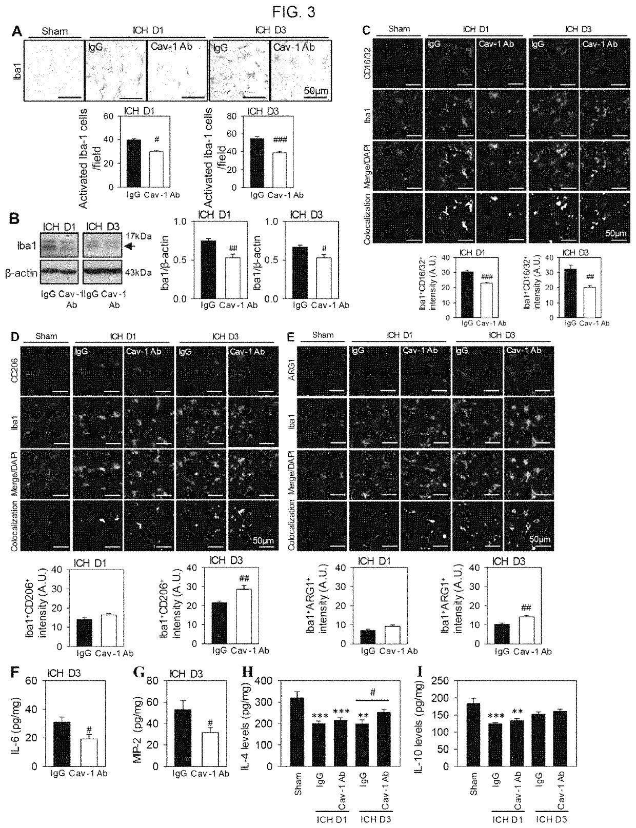 Caveolin-1 antibody for use in treating brain inflammation and injury and improving functional recovery