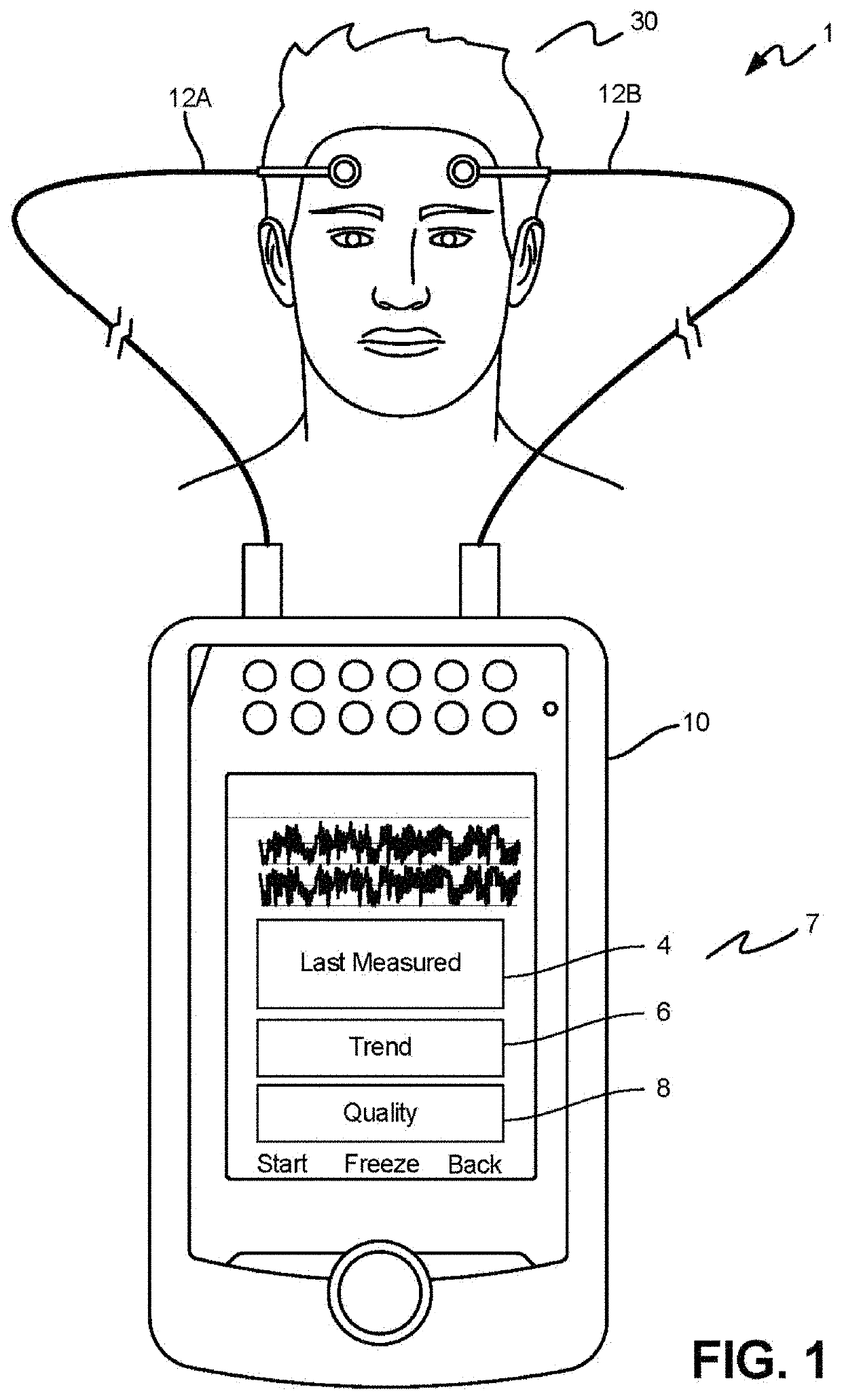 Apparatus, systems and methods for predicting, screening and monitoring of mortality and other conditions   uirf 19054