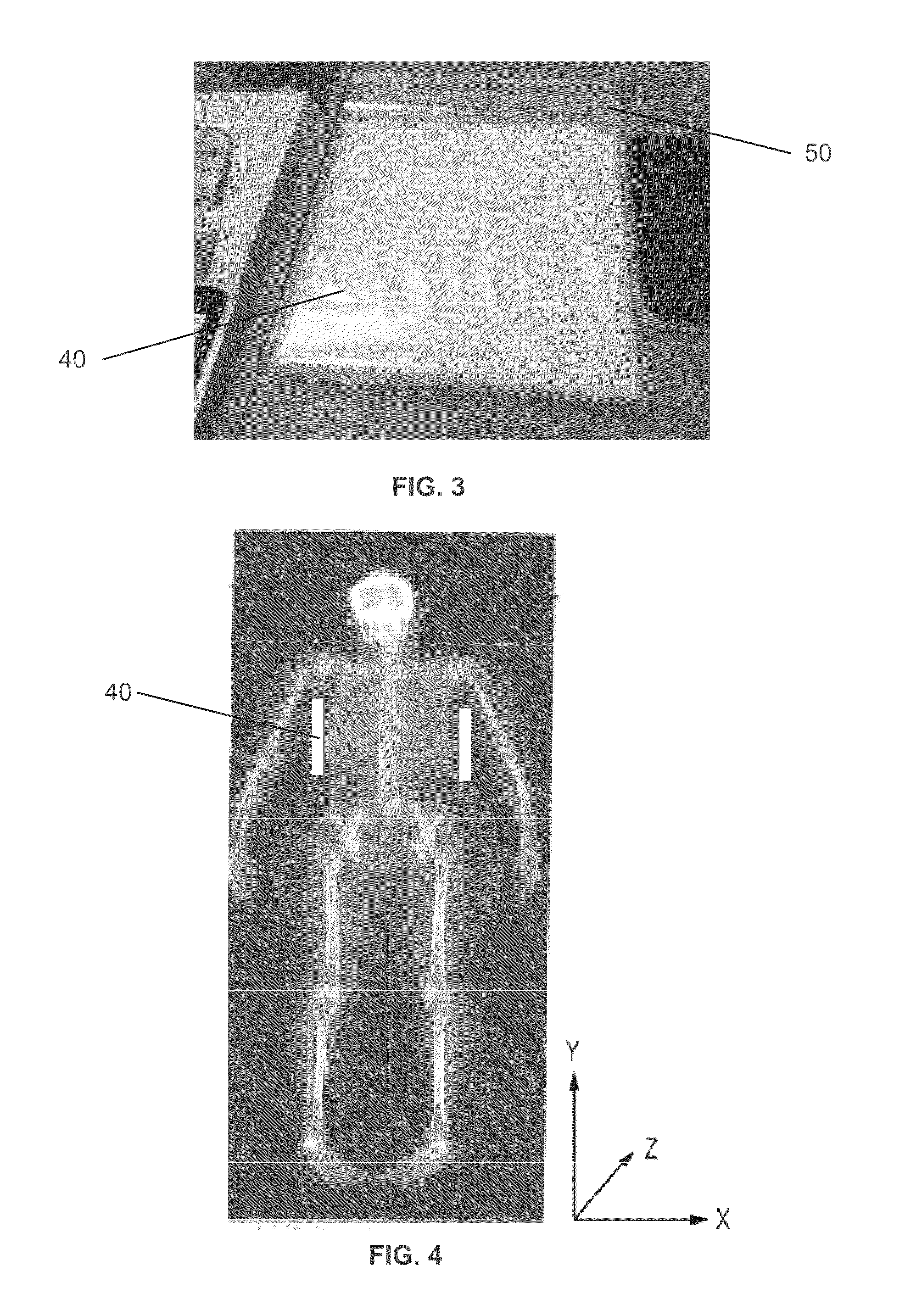 Patient support pads for use in detecting lymphedema through x-ray scans