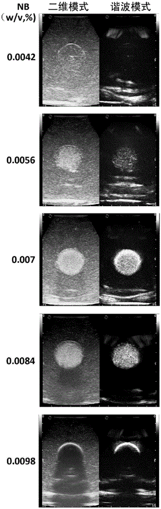 Profile model for simulating performance of tumor contrast-enhanced ultrasonography and applied in tumor diagnosis and treatment study