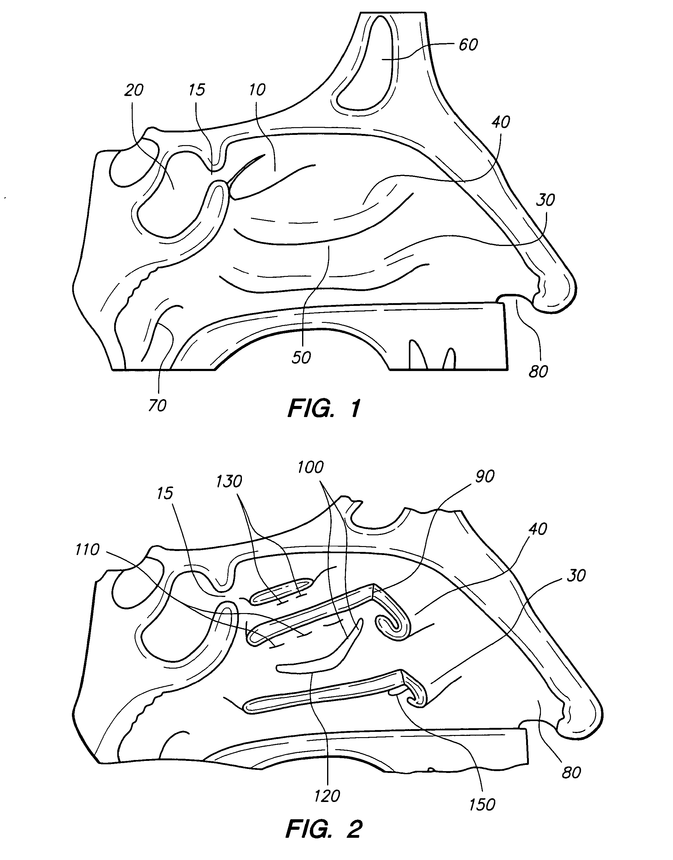 Methods and devices for protecting nasal turbinates