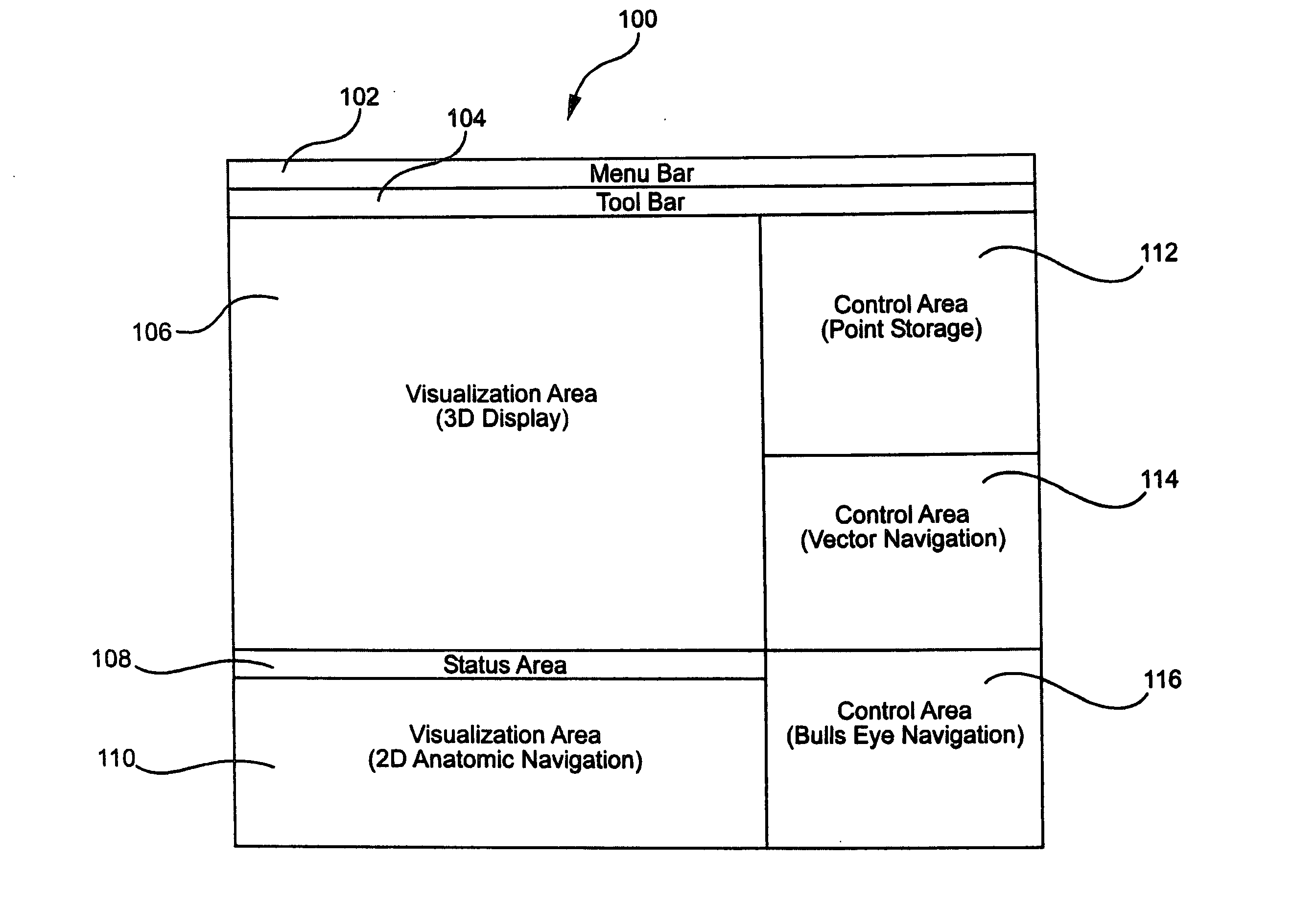 User interface for remote control of medical devices