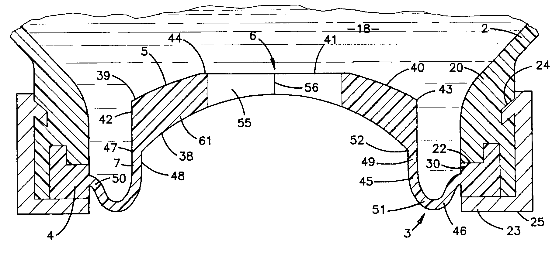 Dispensing valve