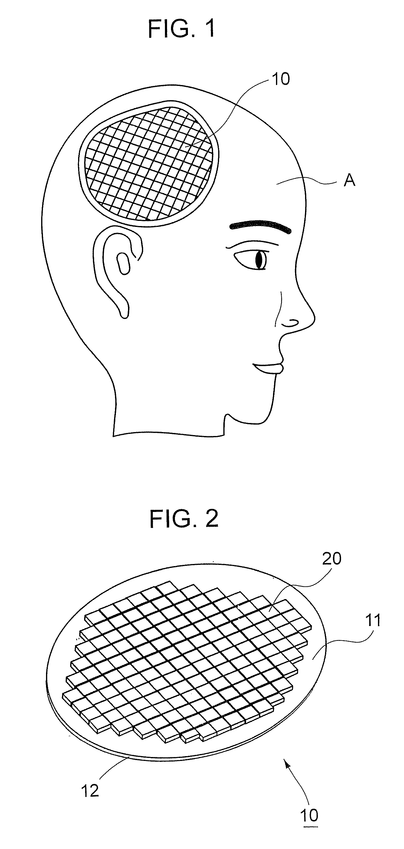 Ultrasonic Wave Radiator for Treatment