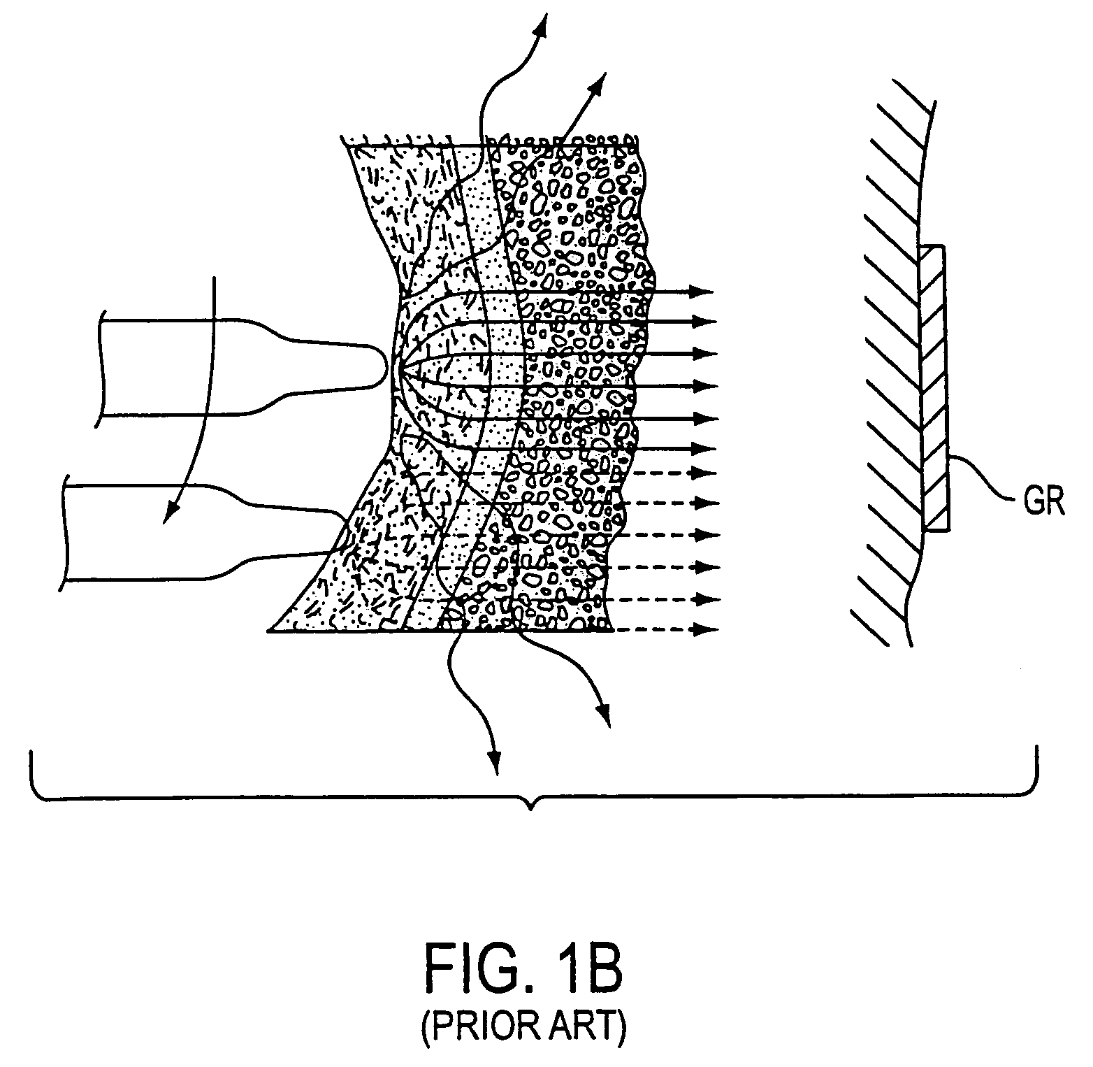 RF electrode array for low-rate collagen shrinkage in capsular shift procedures and methods of use