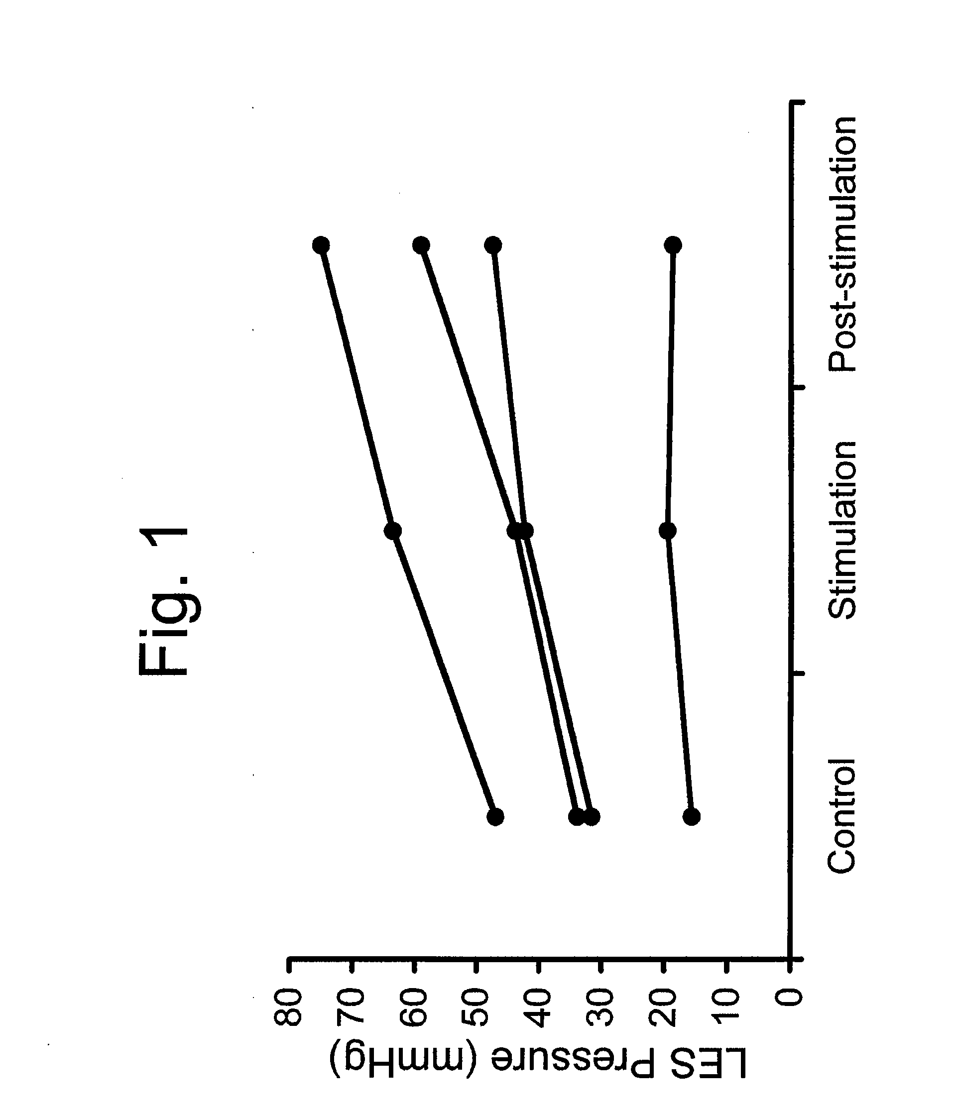 Use of electrical stimulation of the lower esophageal sphincter to modulate lower esophageal sphincter pressure