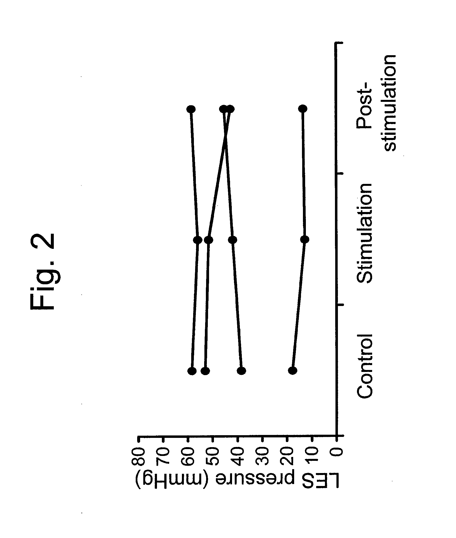 Use of electrical stimulation of the lower esophageal sphincter to modulate lower esophageal sphincter pressure