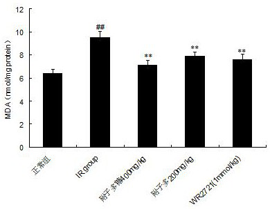 Application of radix aconiti carmichaeli polysaccharide to preparation of medicine for resisting radiation or treating ionizing radiation injury