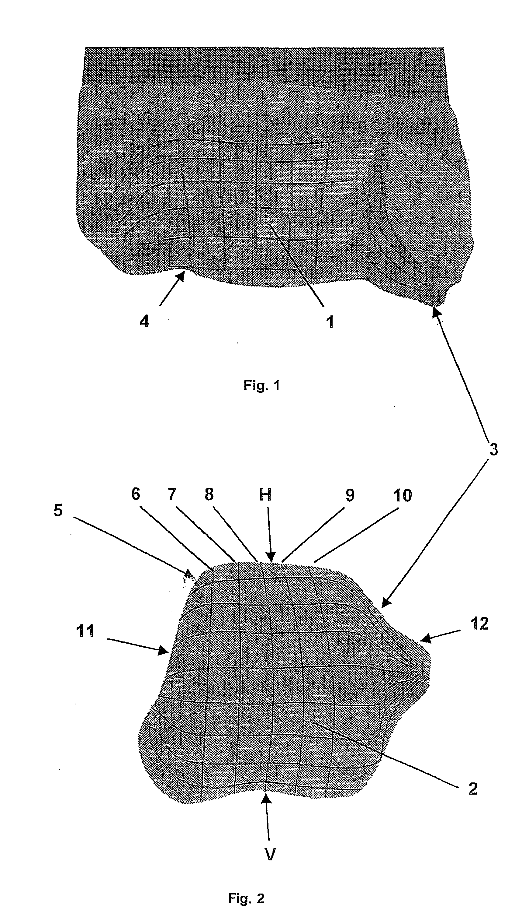 Artificial joint