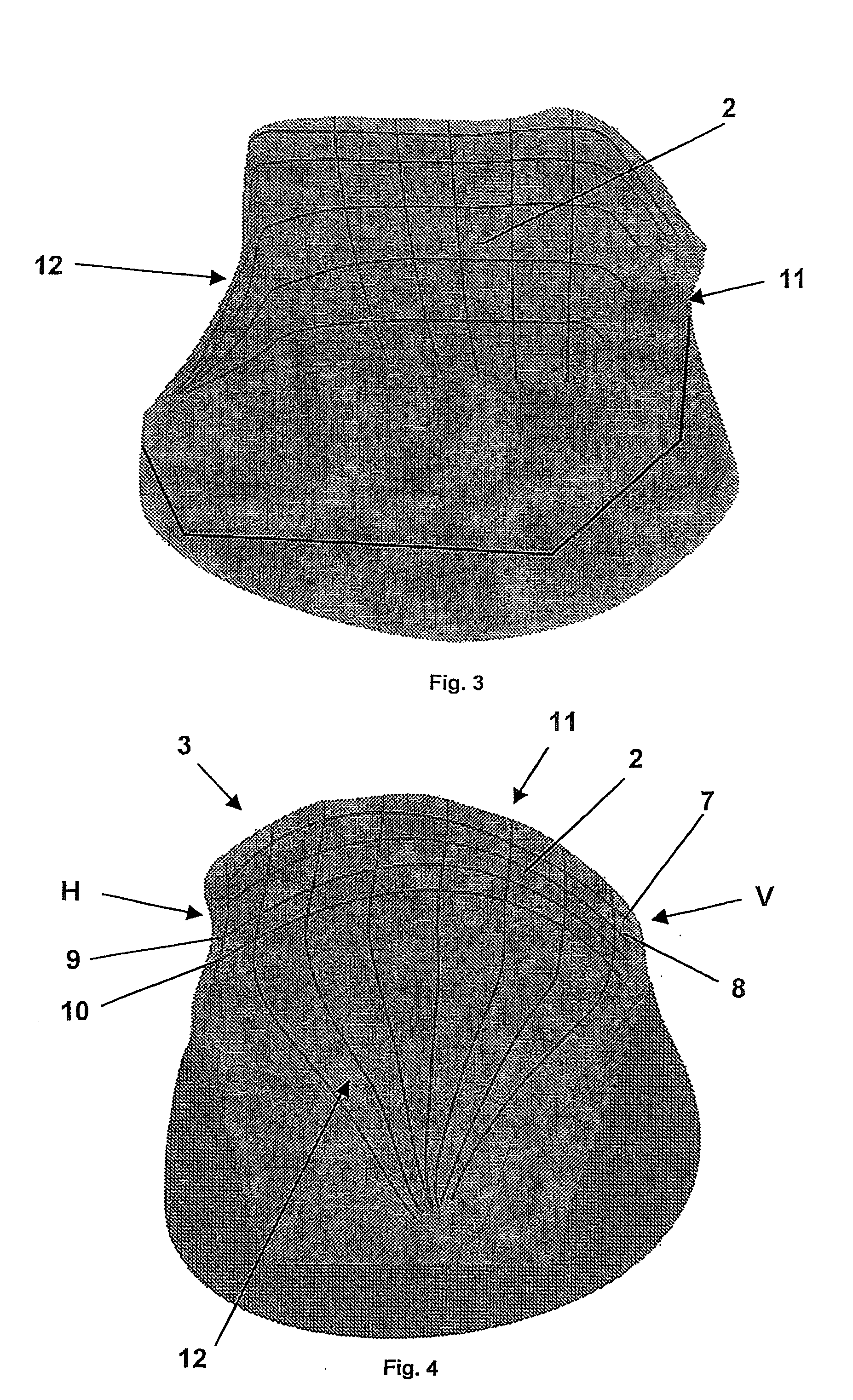 Artificial joint