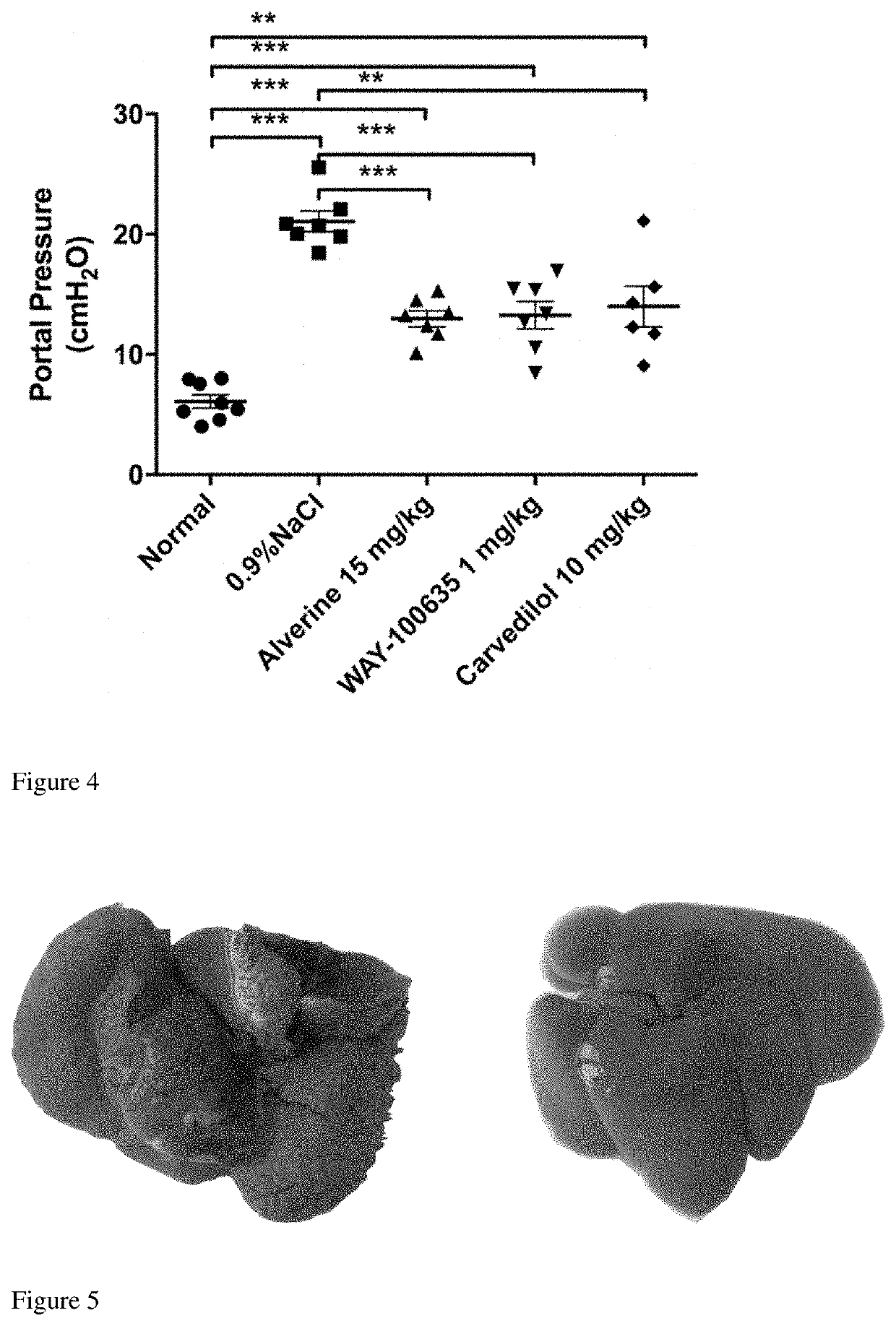 Application of 5-hydroxytryptamine receptor 1a in preparing drug for portal hypertension